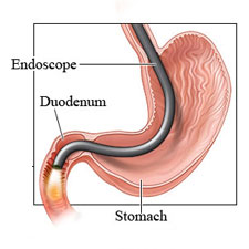 Gastroenterology and Endoscopy